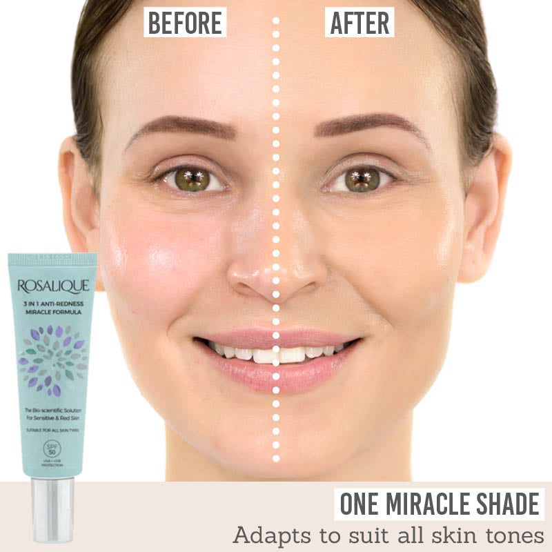 Rosalique 3 in 1 Anti Redness Miracle Formula before and after results
