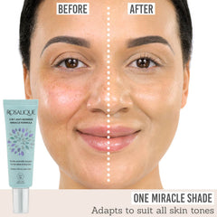 Rosalique 3 in 1 Anti Redness Miracle Formula before and after results
