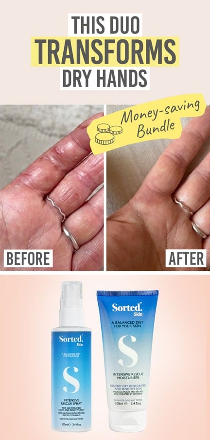 Sorted Skin Intensive Rescue Spray and Moisturiser Duo - Beauty and the Boutique - This duo transforms dry hands